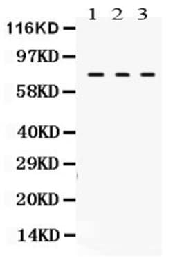 Invitrogen TGM2 Polyclonal Antibody 100 &mu;g; Unconjugated:Antibodies,