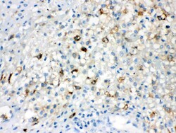 TLR5 Polyclonal Antibody:Antibodies, Polyclonal