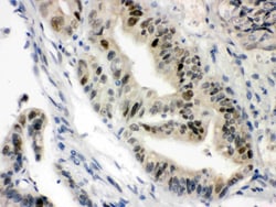 Invitrogen VDR Polyclonal Antibody 100 &mu;g; Unconjugated:Antibodies,