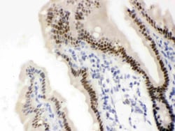 Invitrogen VDR Polyclonal Antibody 100 &mu;g; Unconjugated:Antibodies,