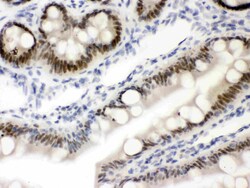 Invitrogen VDR Polyclonal Antibody 100 &mu;g; Unconjugated:Antibodies,