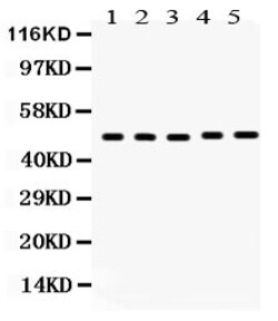 Invitrogen VDR Polyclonal Antibody 100 &mu;g; Unconjugated:Antibodies,
