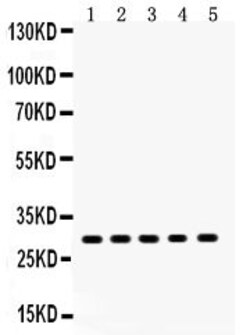 Invitrogen XBP1 Polyclonal Antibody 100 &mu;g; Unconjugated:Antibodies,