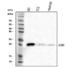 Invitrogen Calmyrin Polyclonal Antibody 100 &mu;g | Buy Online | Invitrogen&trade; | Fisher Scientific