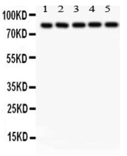 Invitrogen&trade;&nbsp;SOX5 Polyclonal Antibody