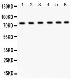 Invitrogen TRPV5 Polyclonal Antibody 100 &mu;g; Unconjugated:Antibodies,