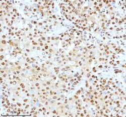 Invitrogen Ku70 Polyclonal Antibody 100 &mu;g; Unconjugated:Antibodies,