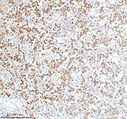 Invitrogen Ku70 Polyclonal Antibody 100 &mu;g; Unconjugated:Antibodies,