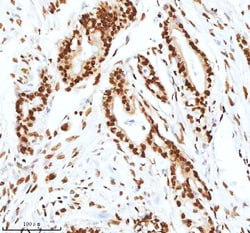 Invitrogen Ku70 Polyclonal Antibody 100 &mu;g; Unconjugated:Antibodies,