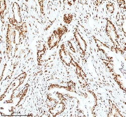 Invitrogen Ku70 Polyclonal Antibody 100 &mu;g; Unconjugated:Antibodies,