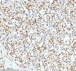 Invitrogen Ku70 Polyclonal Antibody 100 &mu;g; Unconjugated:Antibodies,