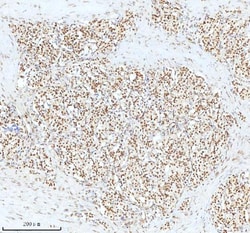 Invitrogen Ku70 Polyclonal Antibody 100 &mu;g; Unconjugated:Antibodies,