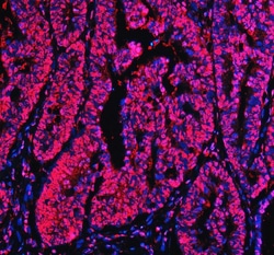 Invitrogen Ku70 Polyclonal Antibody 100 &mu;g; Unconjugated:Antibodies,