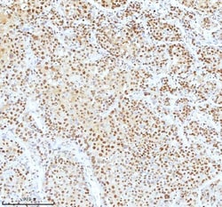 Invitrogen Ku70 Polyclonal Antibody 100 &mu;g; Unconjugated:Antibodies,
