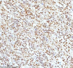 Invitrogen Ku70 Polyclonal Antibody 100 &mu;g; Unconjugated:Antibodies,