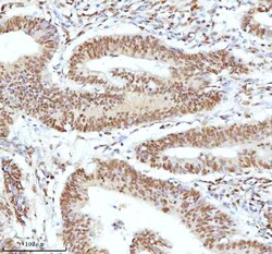 Invitrogen Ku70 Polyclonal Antibody 100 &mu;g; Unconjugated:Antibodies,