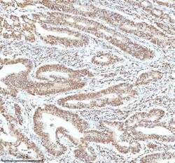 Invitrogen Ku70 Polyclonal Antibody 100 &mu;g; Unconjugated:Antibodies,