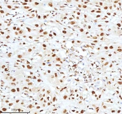 Invitrogen Ku70 Polyclonal Antibody 100 &mu;g; Unconjugated:Antibodies,