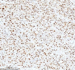 Invitrogen Ku70 Polyclonal Antibody 100 &mu;g; Unconjugated:Antibodies,