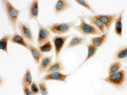 Invitrogen COMT Polyclonal Antibody 100 &mu;g; Unconjugated:Antibodies,