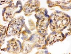 Invitrogen COMT Polyclonal Antibody 100 &mu;g; Unconjugated:Antibodies,