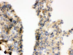 Invitrogen COMT Polyclonal Antibody 100 &mu;g; Unconjugated:Antibodies,