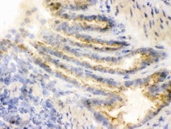 Invitrogen COMT Polyclonal Antibody 100 &mu;g; Unconjugated:Antibodies,