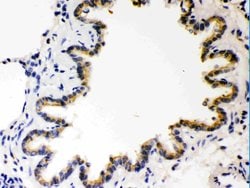 Invitrogen COMT Polyclonal Antibody 100 &mu;g; Unconjugated:Antibodies,