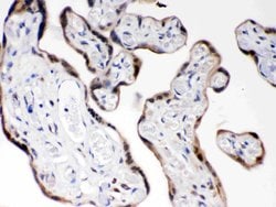 Invitrogen COMT Polyclonal Antibody 100 &mu;g; Unconjugated:Antibodies,