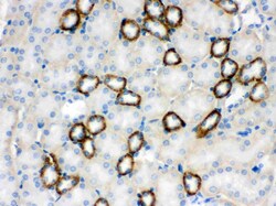 Invitrogen CYP1B1 Polyclonal Antibody 100 &mu;g | Buy Online | Invitrogen&trade; | Fisher Scientific