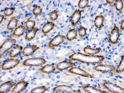 Invitrogen CYP1B1 Polyclonal Antibody 100 &mu;g | Buy Online | Invitrogen&trade; | Fisher Scientific