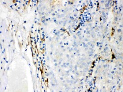 Invitrogen CYP1B1 Polyclonal Antibody 100 &mu;g | Buy Online | Invitrogen&trade; | Fisher Scientific