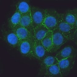 Invitrogen E-cadherin Polyclonal Antibody 100 &mu;g; Unconjugated:Antibodies,