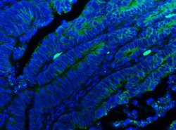 Invitrogen E-cadherin Polyclonal Antibody 100 &mu;g; Unconjugated:Antibodies,