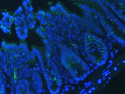 Invitrogen E-cadherin Polyclonal Antibody 100 &mu;g; Unconjugated:Antibodies,