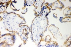 Invitrogen E-cadherin Polyclonal Antibody 100 &mu;g; Unconjugated:Antibodies,