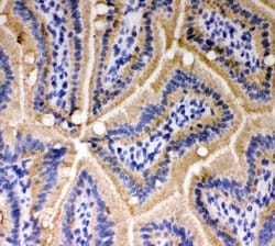 Invitrogen E-cadherin Polyclonal Antibody 100 &mu;g; Unconjugated:Antibodies,
