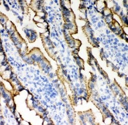 Invitrogen E-cadherin Polyclonal Antibody 100 &mu;g; Unconjugated:Antibodies,