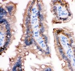 Invitrogen E-cadherin Polyclonal Antibody 100 &mu;g; Unconjugated:Antibodies,