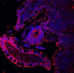 Invitrogen E-cadherin Polyclonal Antibody 100 &mu;g; Unconjugated:Antibodies,