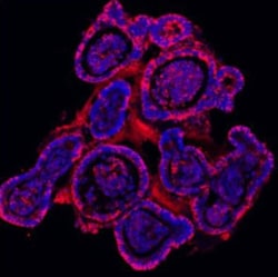 Invitrogen E-cadherin Polyclonal Antibody 100 &mu;g; Unconjugated:Antibodies,