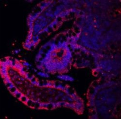 Invitrogen E-cadherin Polyclonal Antibody 100 &mu;g; Unconjugated:Antibodies,