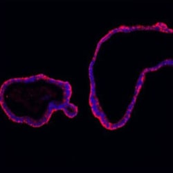 Invitrogen E-cadherin Polyclonal Antibody 100 &mu;g; Unconjugated:Antibodies,