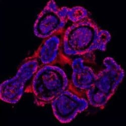 Invitrogen E-cadherin Polyclonal Antibody 100 &mu;g; Unconjugated:Antibodies,