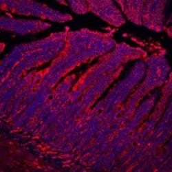 Invitrogen E-cadherin Polyclonal Antibody 100 &mu;g; Unconjugated:Antibodies,