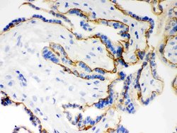 Invitrogen E-cadherin Polyclonal Antibody 100 &mu;g; Unconjugated:Antibodies,