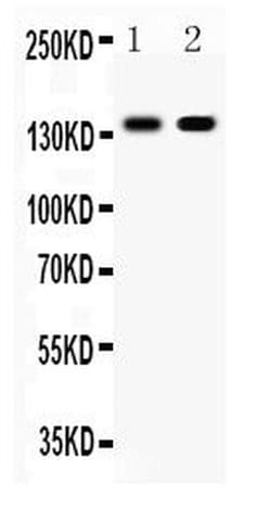 Invitrogen E-cadherin Polyclonal Antibody 100 &mu;g; Unconjugated:Antibodies,