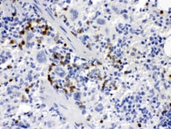 Invitrogen M-CSF Polyclonal Antibody 100 &mu;g | Buy Online | Invitrogen&trade; | Fisher Scientific
