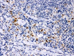 Invitrogen M-CSF Polyclonal Antibody 100 &mu;g | Buy Online | Invitrogen&trade; | Fisher Scientific