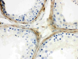 Invitrogen Apolipoprotein J Polyclonal Antibody 100 &mu;g; Unconjugated:Antibodies,
